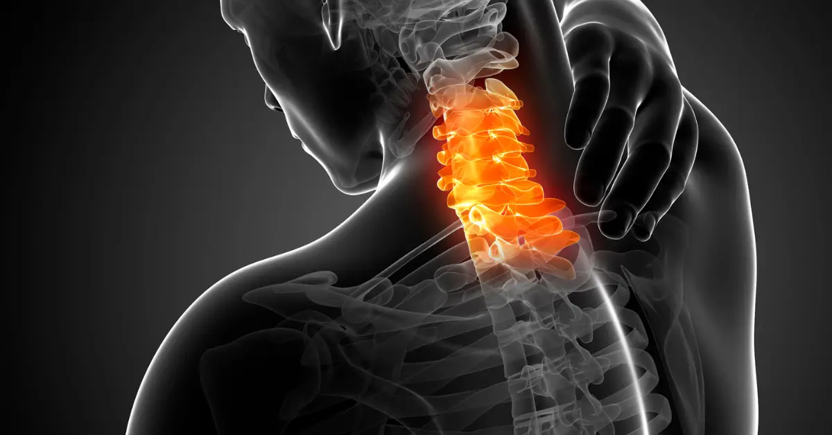 Chronic Neck Pain: All You Need To Know